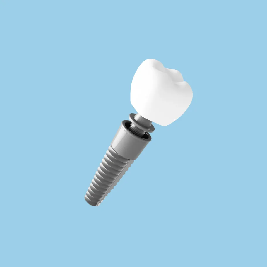 1.インプラント治療