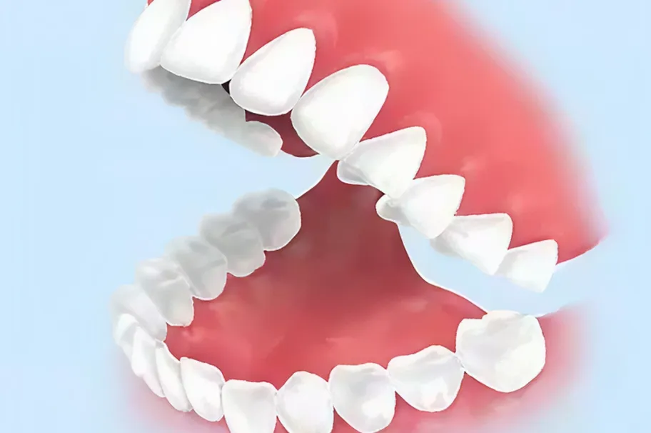 噛み合わせのチェック