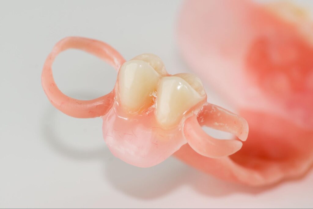 ノンクラスプデンチャー