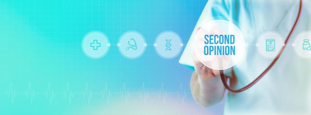 セカンドオピニオンとは